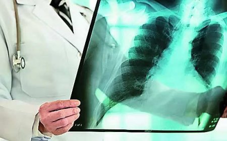 Trial results pending, but TB supplement gets govt nod