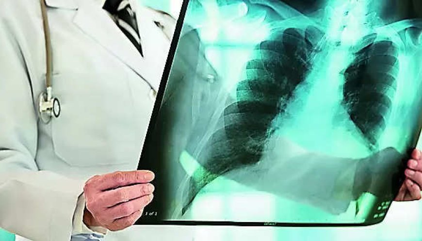 Trial results pending, but TB supplement gets govt nod