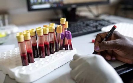 HIV jab for 115 nations rests on Indian regulators