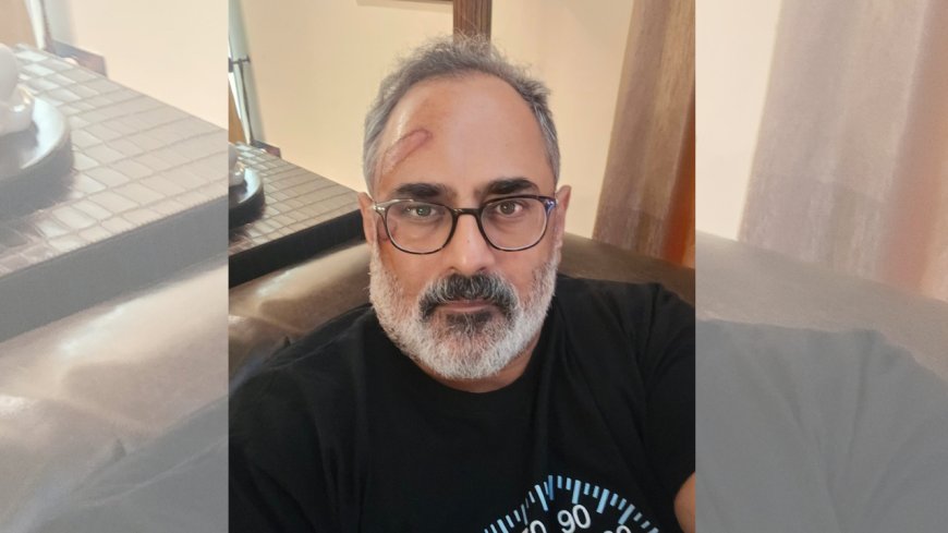 ‘Pain as a consequence’: BJP Kerala chief Rajeev Chandrasekhar injured in treadmill fall, shares lesson