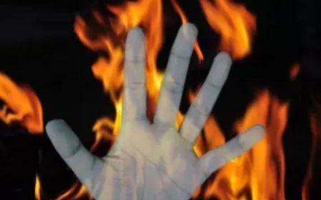 19-year-old set afire in front of college