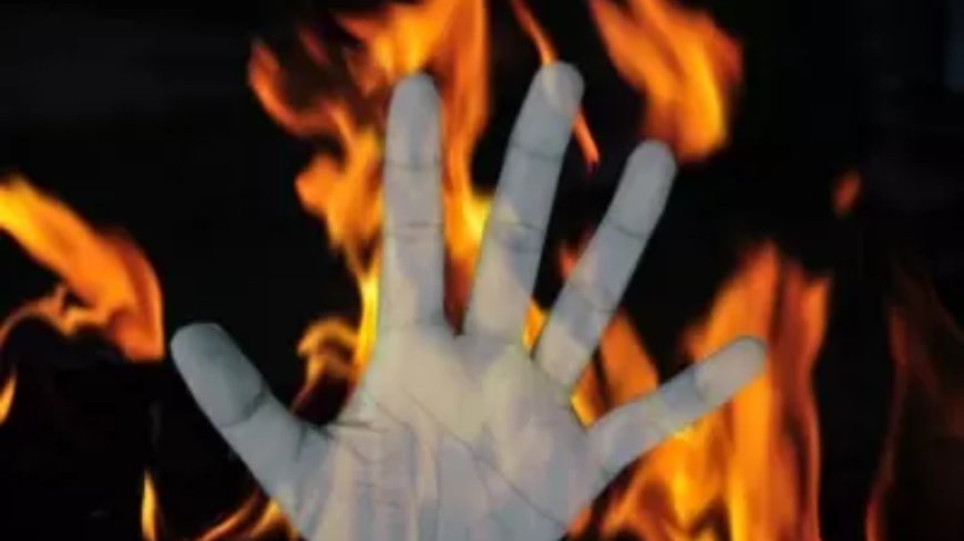 19-year-old set afire in front of college