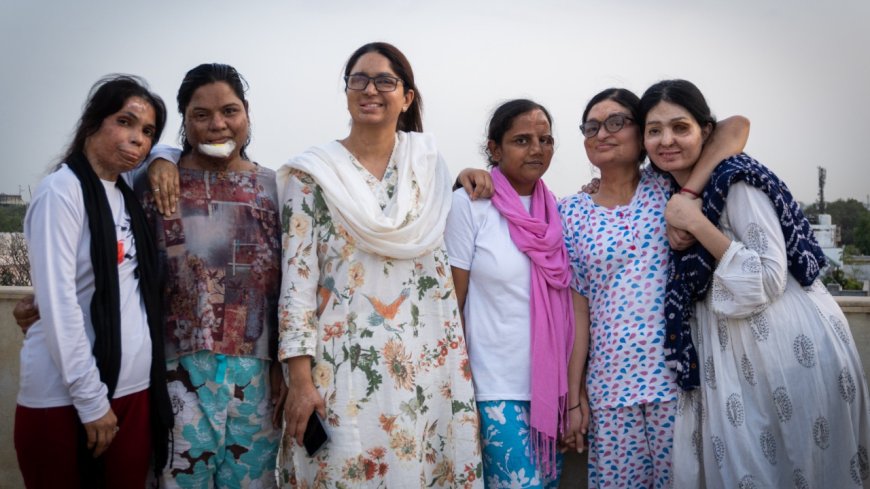‘Have to live with scars for life but will fight on’: Acid attack survivor after SC flags lifelong trauma