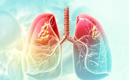 AIIMS-Delhi to study link between lung cancer and air pollution